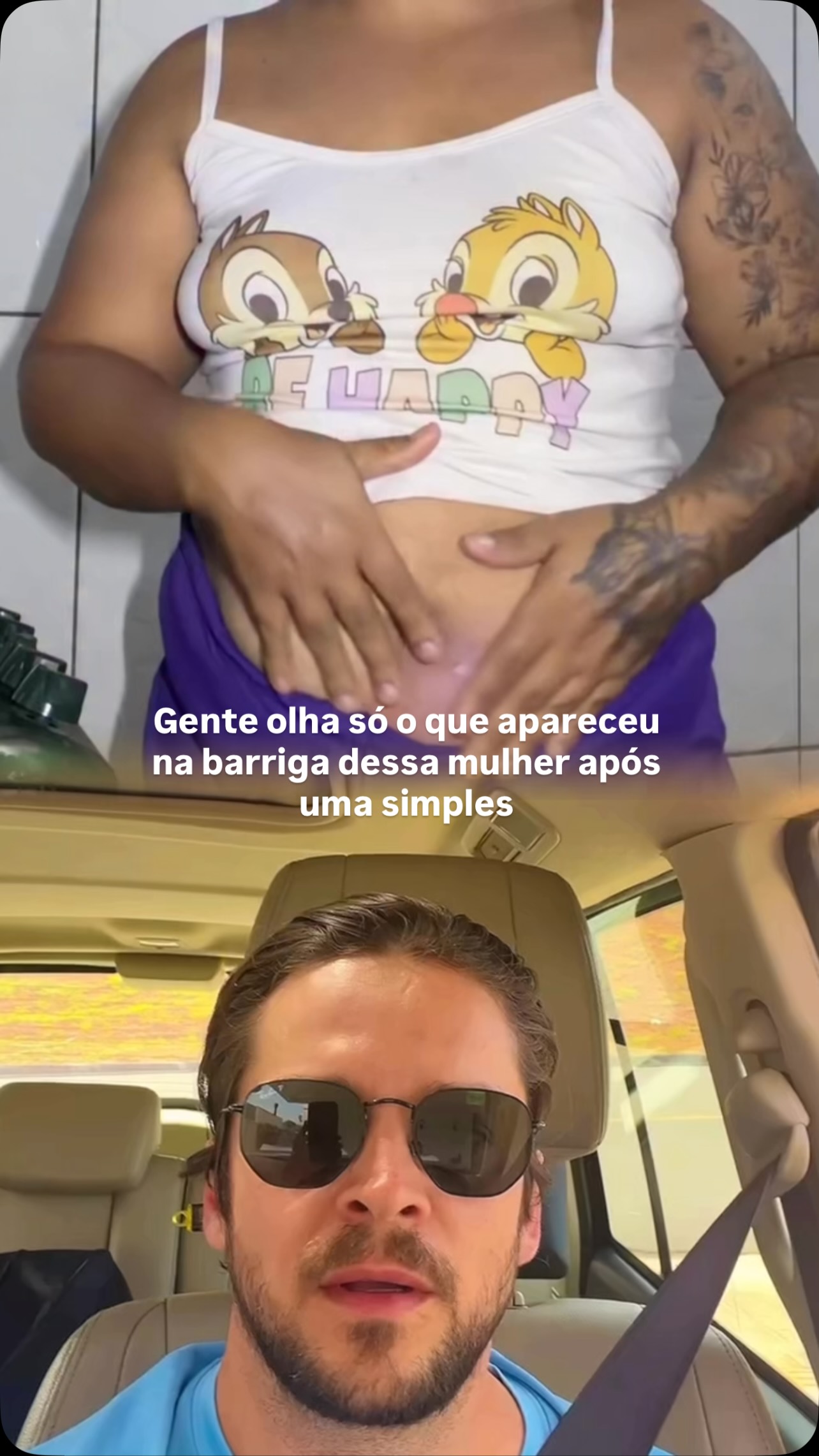 Isso aqui apareceu na barriga depois de uma aplicação de #Mounjaro. E essa imagem me preocupa de verdade!

Olha o tamanho dessa %lesão: uma área extensa, avermelhada, arroxeada, elevada, com aspecto inflamatório importante, localizada logo abaixo do umbigo. 

Muita gente banalizou tanto essas medicações que esqueceu o óbvio: 

Mounjaro continua sendo um medicamento injetável. E medicamento injetável exige técnica, higiene, procedência e armazenamento adequados.

Uma aplicação dura segundos. Uma complicação pode durar semanas, meses, ano ou pior, a pessoa pode morrer. 

O problema não começa só no medicamento. Muitas vezes, ele começa na forma como esse medicamento chega até a #pele. Compartilhe esse vídeo com quem precisa entender sobre esses riscos. 

Dr. Victor Dias-CRM: 174268