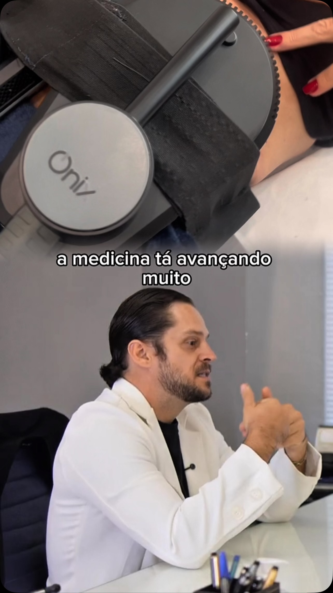 Na era do #emagrecimento rápido com as “canetinhas”, preservar a massa muscular precisa fazer parte de nossas intervenções. A perda de peso pode vir acompanhada de redução de músculos e maior evidência de #flacidez. Por isso, #alimentação adequada, proteínas e treino de força são fundamentais para #emagrecer com saúde e qualidade corporal.

A tecnologia pode complementar esse cuidado: o campo eletromagnético de alta intensidade provoca contrações musculares intensas e apresenta resultados promissores na melhora da musculatura e do contorno corporal.

Dr. Victor Dias: CRM 174268
Emagrecimento | Medicina do estilo de vida | Longevidade | Performance física